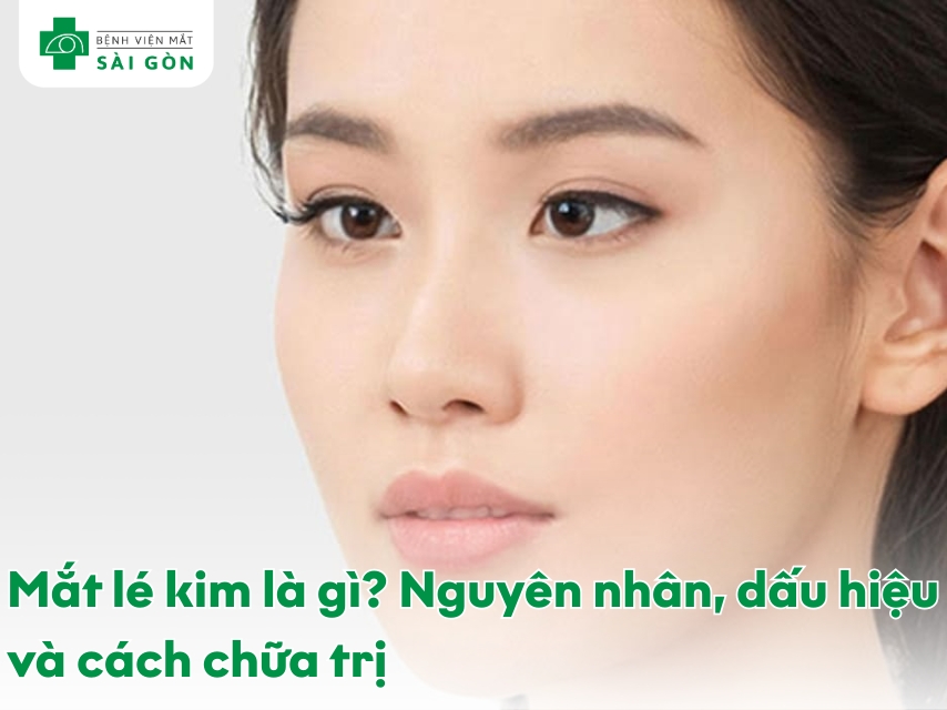 Tìm hiểu về mắt lé kim