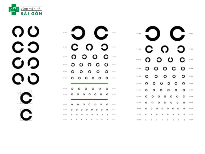 Bảng thị lực Landolt C được coi là tiêu chuẩn