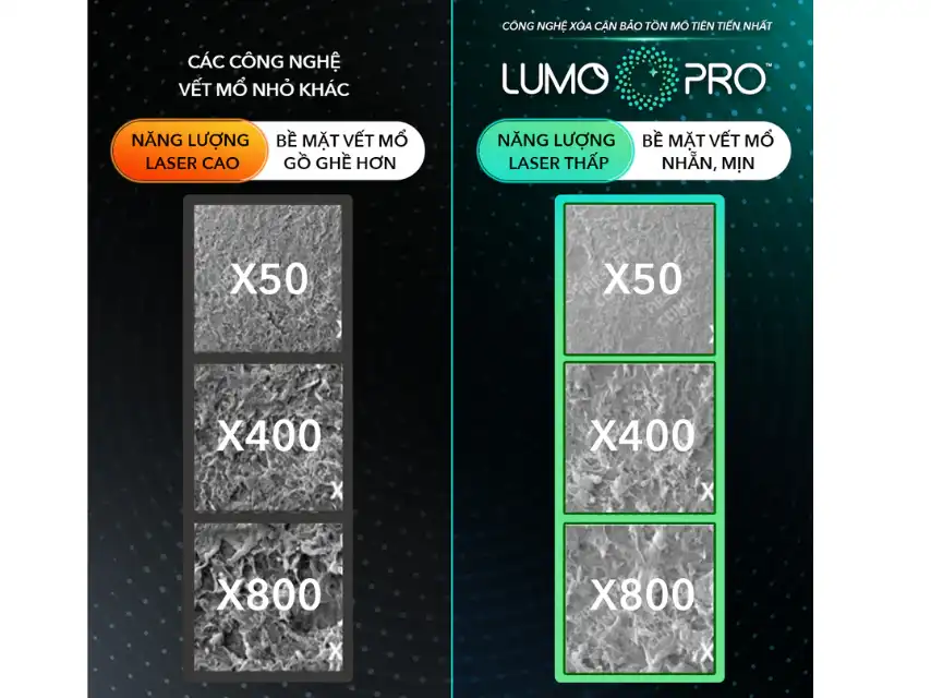 Bề mặt vết mổ sử dụng năng lượng Dịu nhẹ có độ nhẵn mịn và đồng đều trên LUMOPRO™