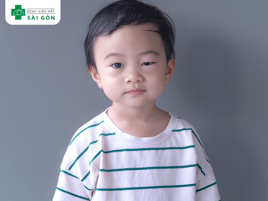 Sưng nhẹ quanh mắt