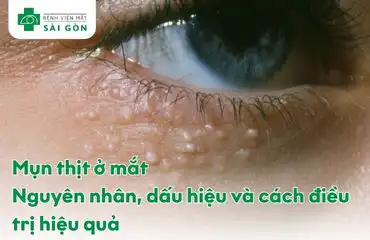 Mụn thịt ở mắt