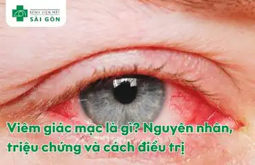 Viêm giác mạc gây đau nhức, đỏ mắt, chảy nước mắt, giảm thị lực