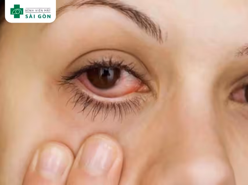 Dấu hiệu nguy hiểm mắt đã bị tổn thương