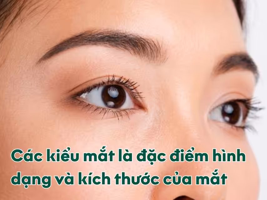 Hình dạng và kích thước mắt