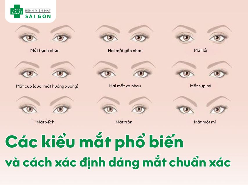 Các kiểu mắt phổ biến