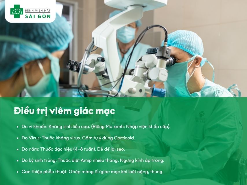 Phương pháp điều trị viêm giác mạc
