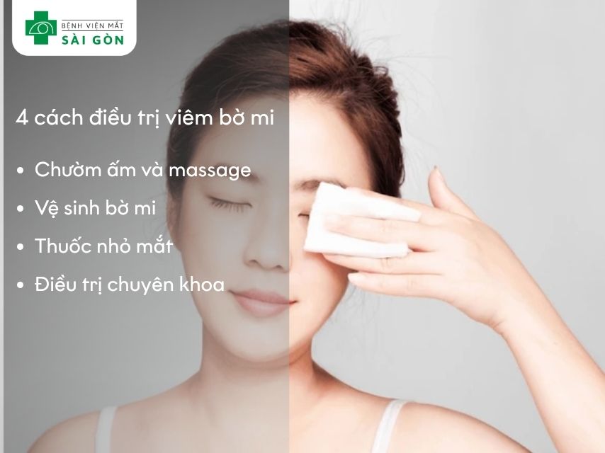 Khi bị bệnh, cần vệ sinh bờ mi hàng ngày và lâu dài để kiểm soát triệu chứng hiệu quả.