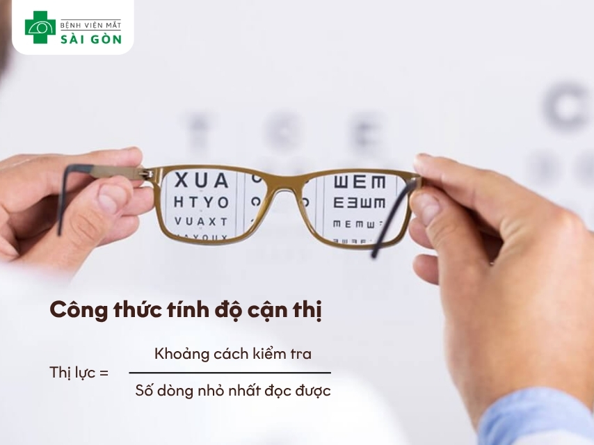 Công thức tính độ cận thị: Thị lực = Khoảng cách kiểm tra / Số dòng nhỏ nhất đọc được