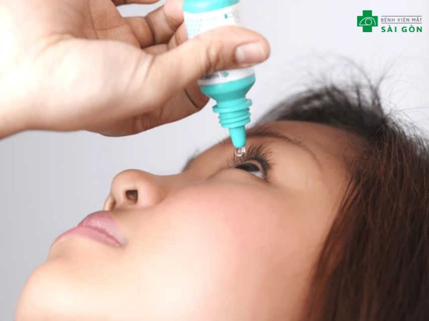 Chăm sóc mắt sau mổ cận 8 độ