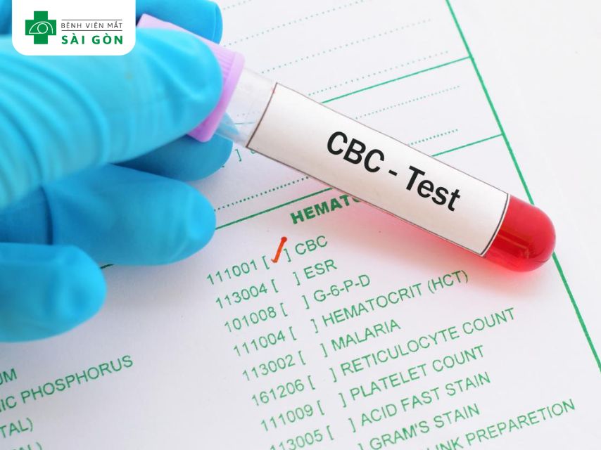 Xét nghiệm giúp chẩn đoán cơ thể thiếu vitamin B12