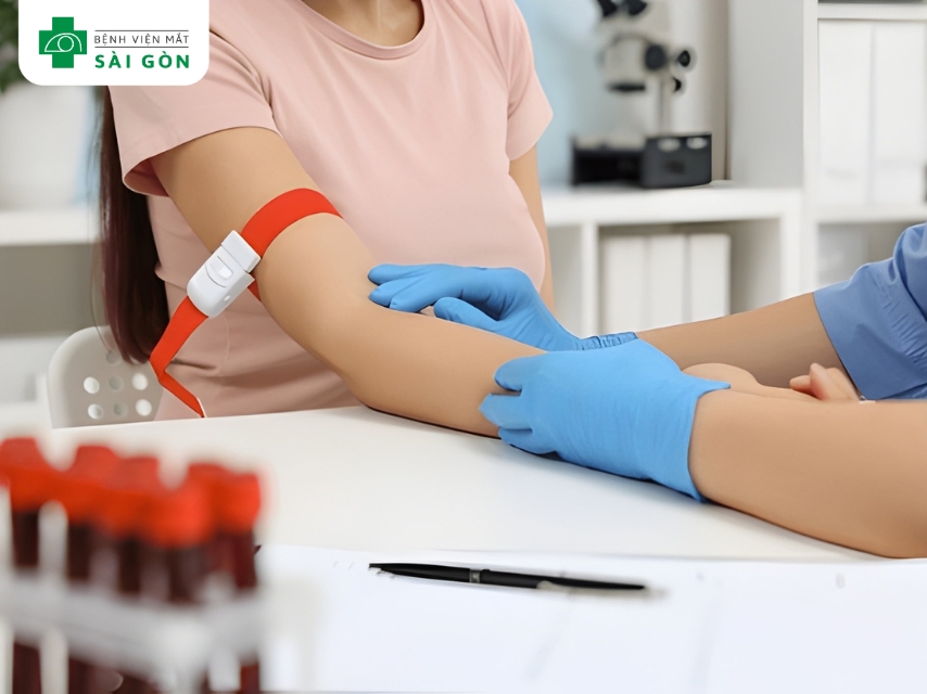 Xét nghiệm máu chẩn đoán mắt vàng 