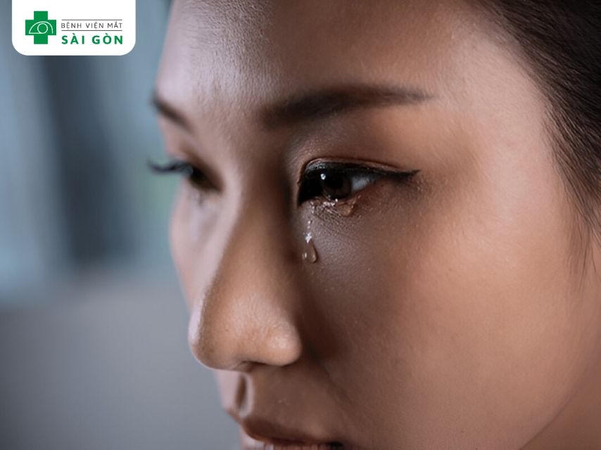 Chảy nước mắt quá mức là dấu hiệu bệnh mắt