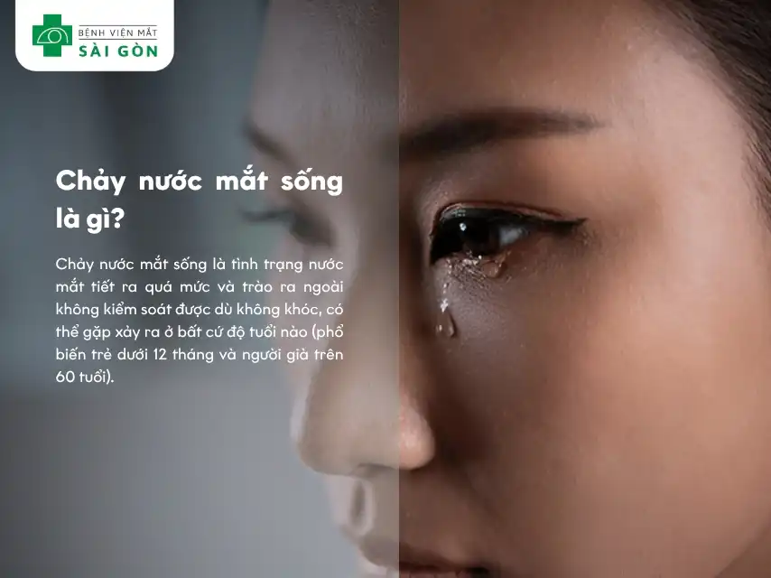 Chảy nước mắt sống là tình trạng gì