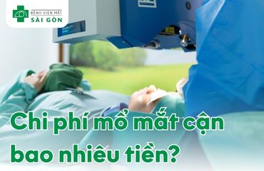 Chi phí mổ mắt cận thị mới nhất