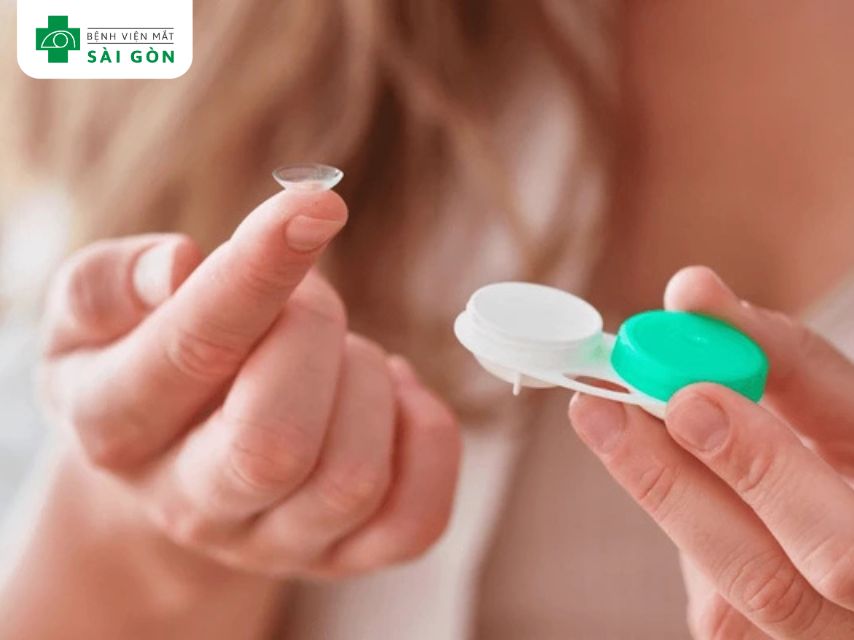 Đeo kính áp tròng gây tổn thương giác mạc