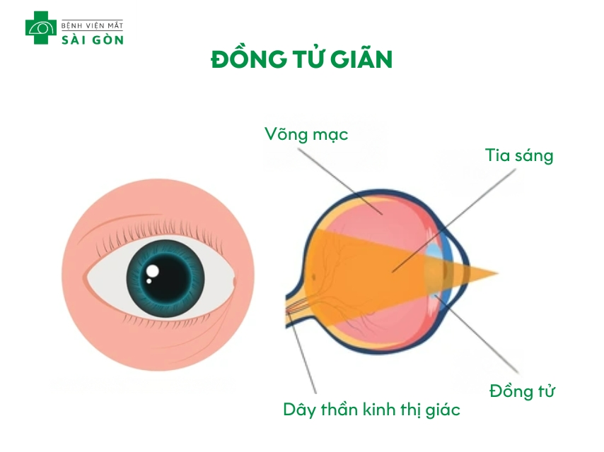 Giãn đồng tử là đồng tử mở rộng để kiểm soát ánh sáng vào mắt