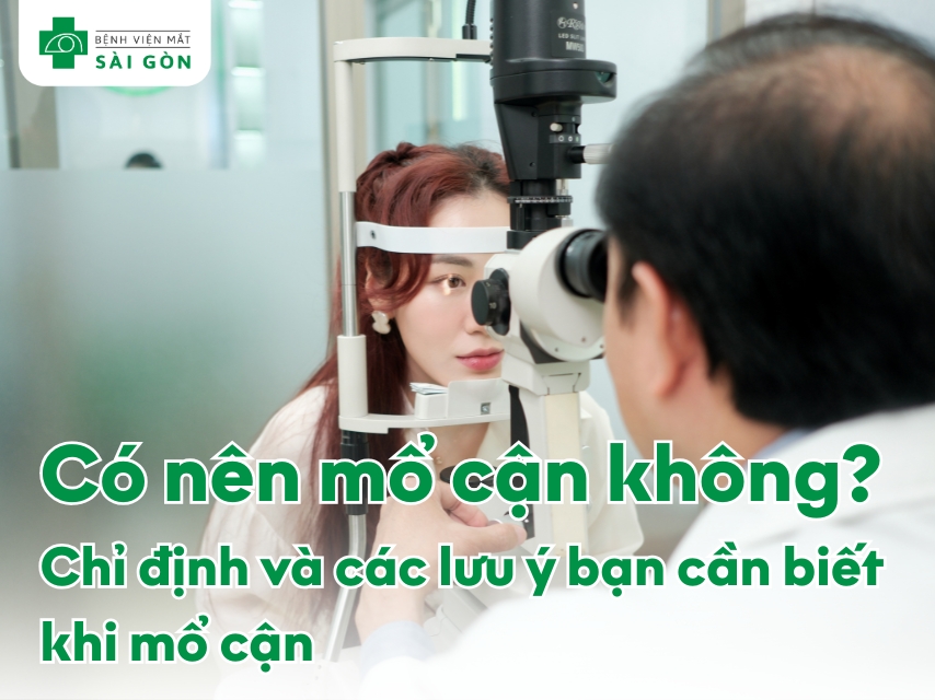  Phẫu thuật giúp hết cận 