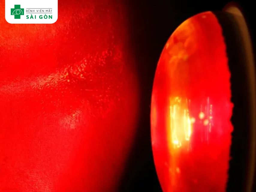 Đặc điểm của tia hồng ngoại