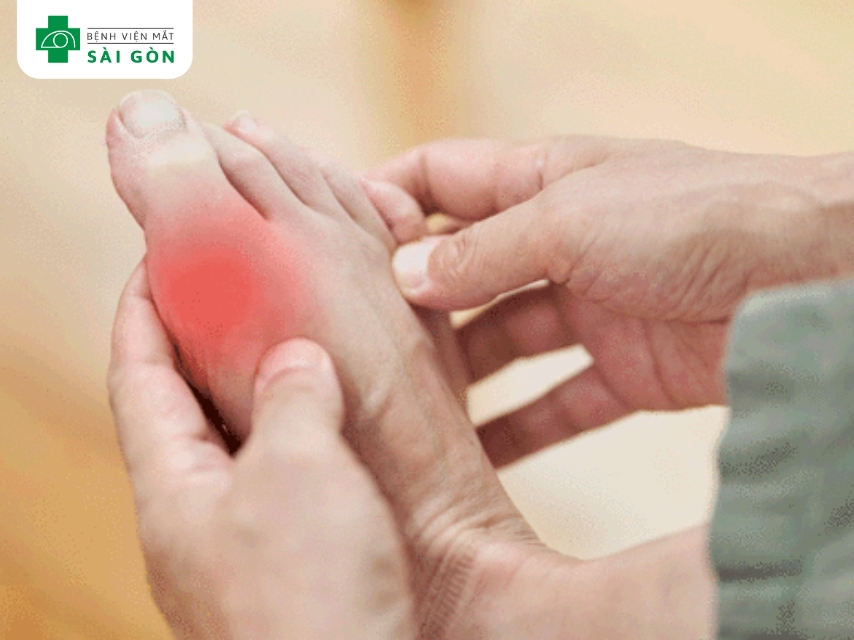 Cảm giác tê bì tay chân là dấu hiệu thiếu Vitamin B12.