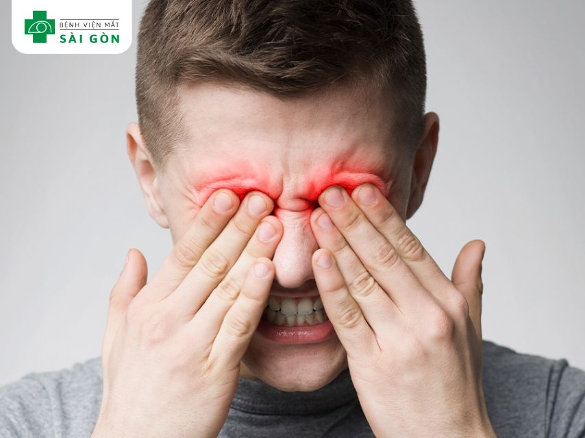 Hóa chất bắn vào mắt