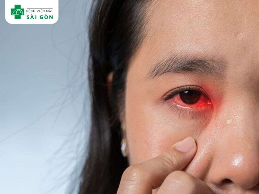 Mắt nhiễm trùng