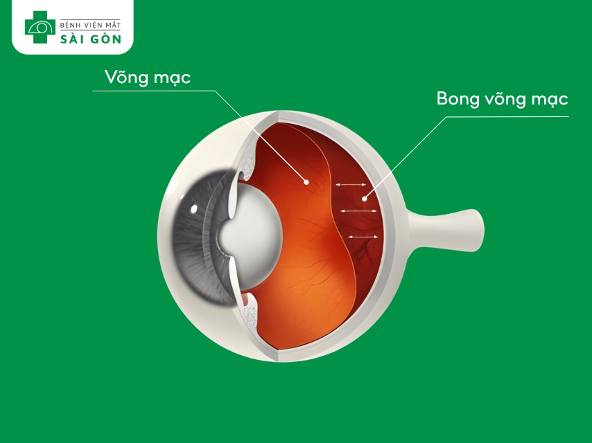 Điều kiện không có các bệnh lý mắt