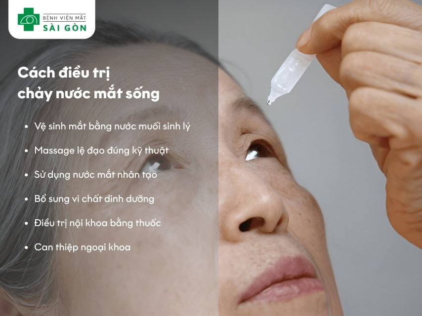 Các cách điều trị chảy nước mắt sống
