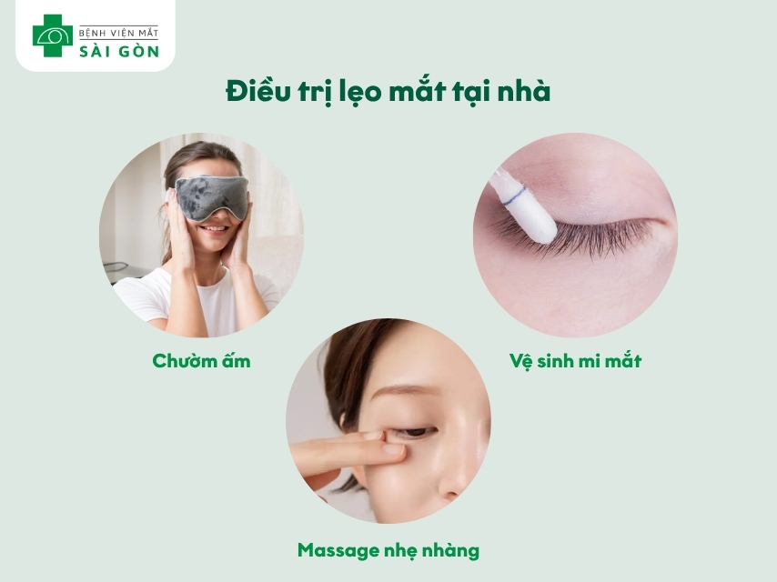 Hướng dẫn điều trị lẹo mắt tại nhà