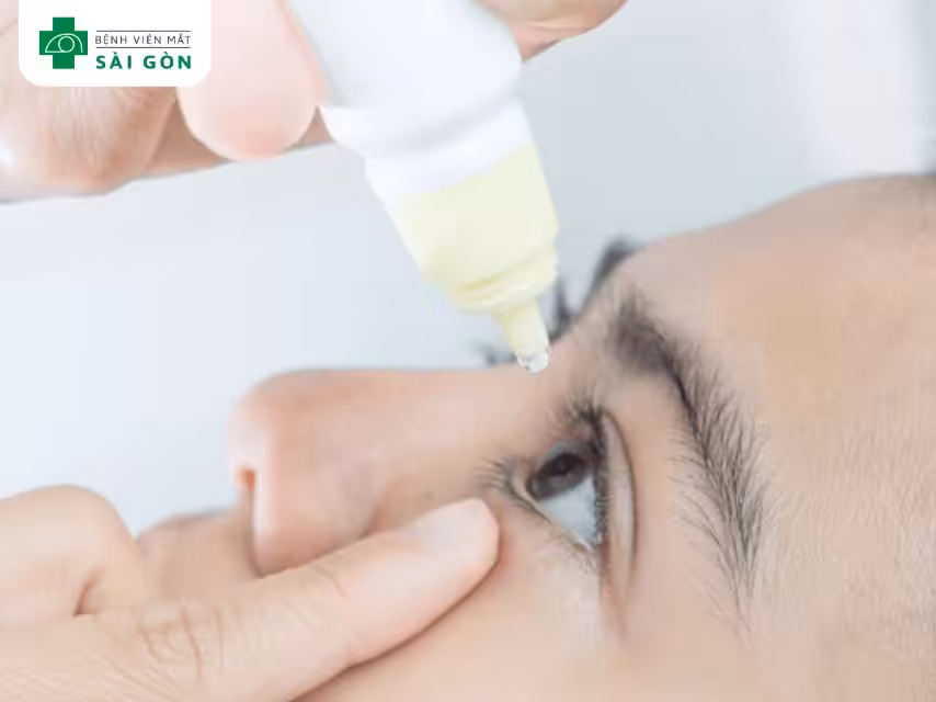 Pilocarpine hydrochloride (Vuity)