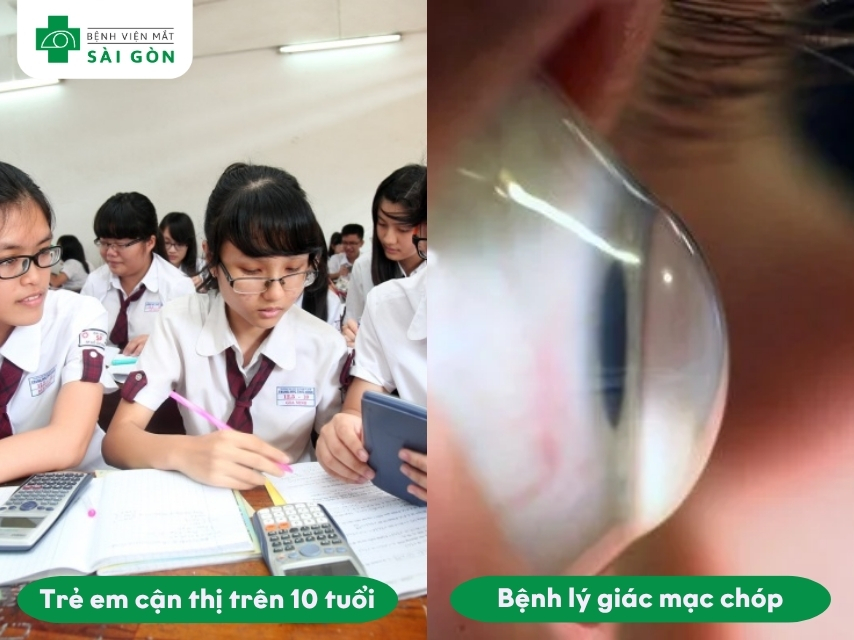 Trẻ em từ 7 tuổi có thể sử dụng kính Ortho-K