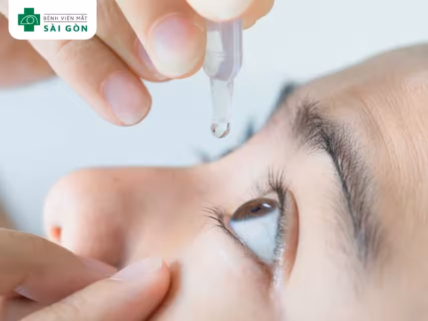 Dùng thuốc nhỏ mắt theo chỉ định bác sĩ