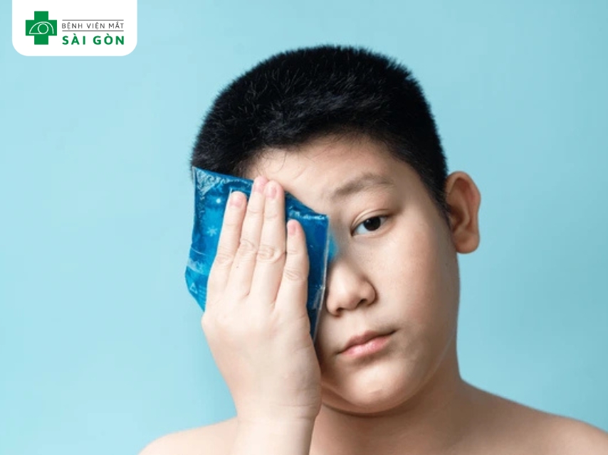 Chườm lạnh giúp co mạch, giảm viêm và ngứa hiệu quả