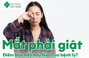Tổng quan tình trạng mắt phải giật