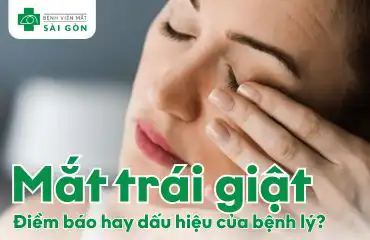 Tổng quan tình trạng mắt trái giật
