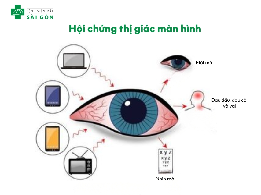 Ánh sáng xanh từ điện thoại gây mỏi mắt