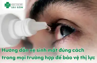 Hướng dẫn vệ sinh mắt