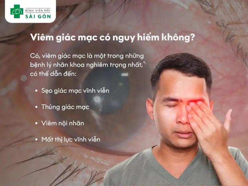 Viêm giác mạc rất nguy hiểm