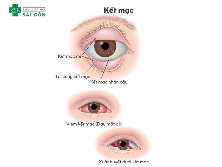 Kết mạc (conjunctiva)