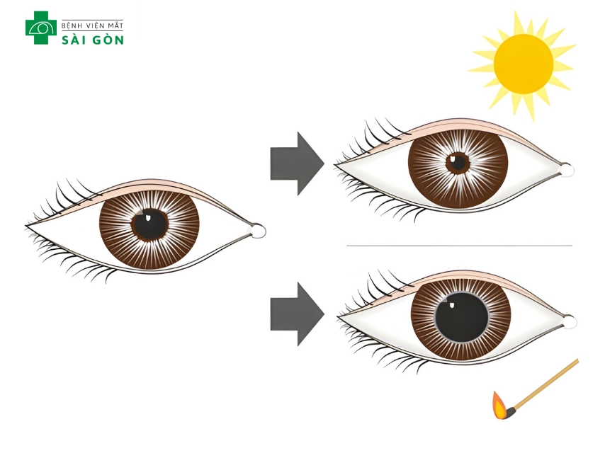 Đồng tử điều chỉnh lượng ánh sáng vào mắt, nằm ở trung tâm mống mắt