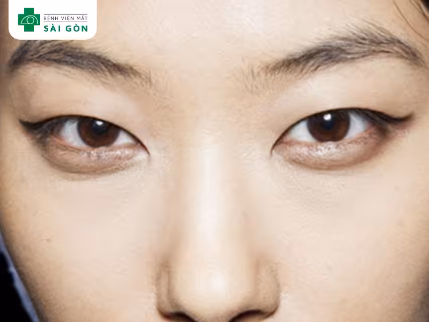 Mắt xếch hay mắt mèo