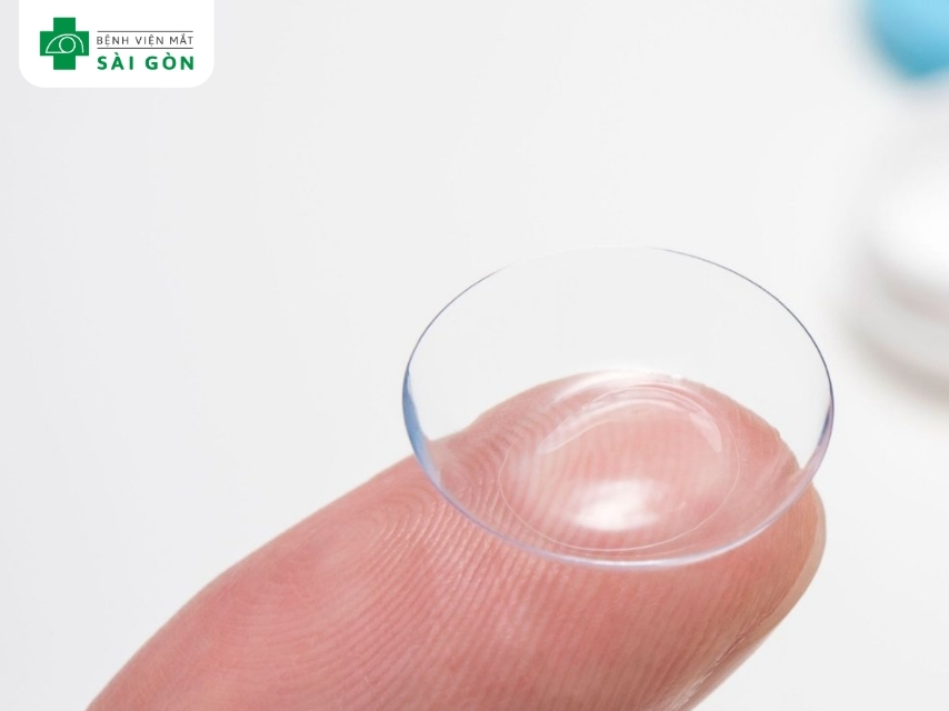 Kính áp tròng cải thiện loạn thị