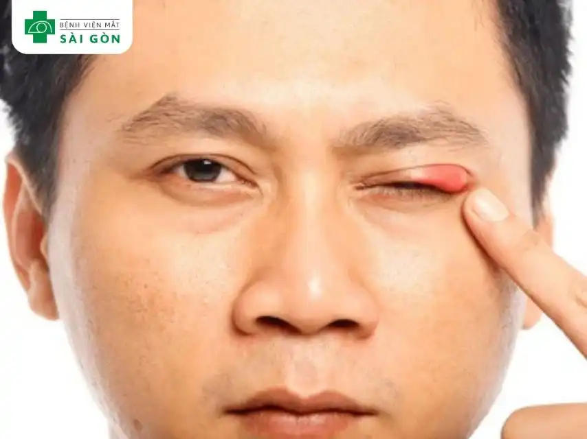 Nguyên nhân bệnh lý tiềm ẩn