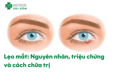lẹo mắt