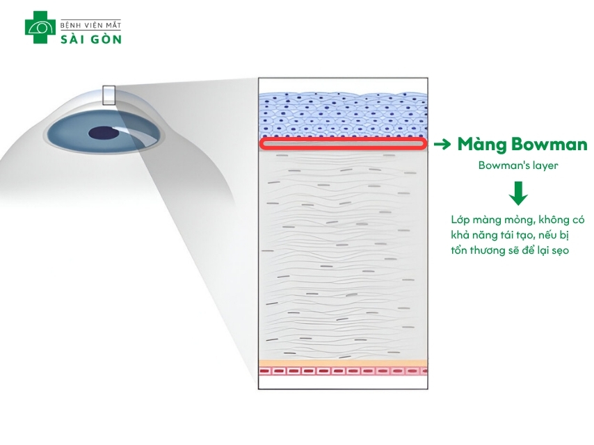 Màng Bowman nếu bị thương sẽ để lại sẹo