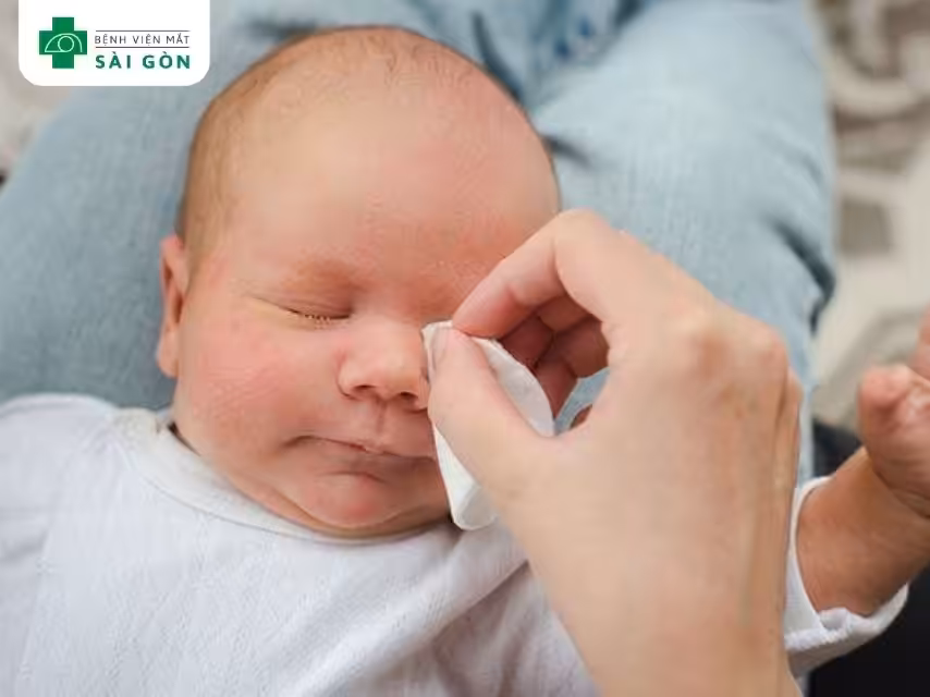 Mắt bé đổ ghèn do bụi bẩn