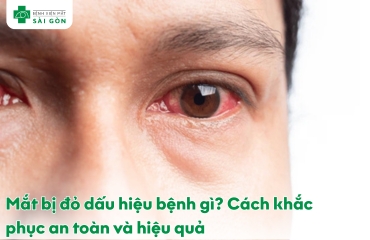 mắt bị đỏ