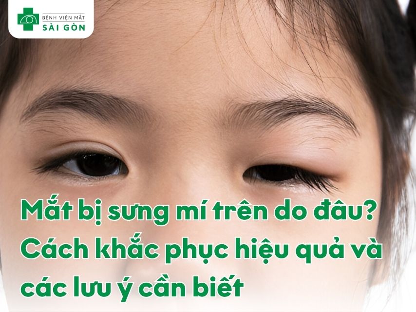 Sưng mí mắt trên xảy ra khi bị viêm