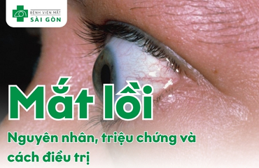 mắt lồi
