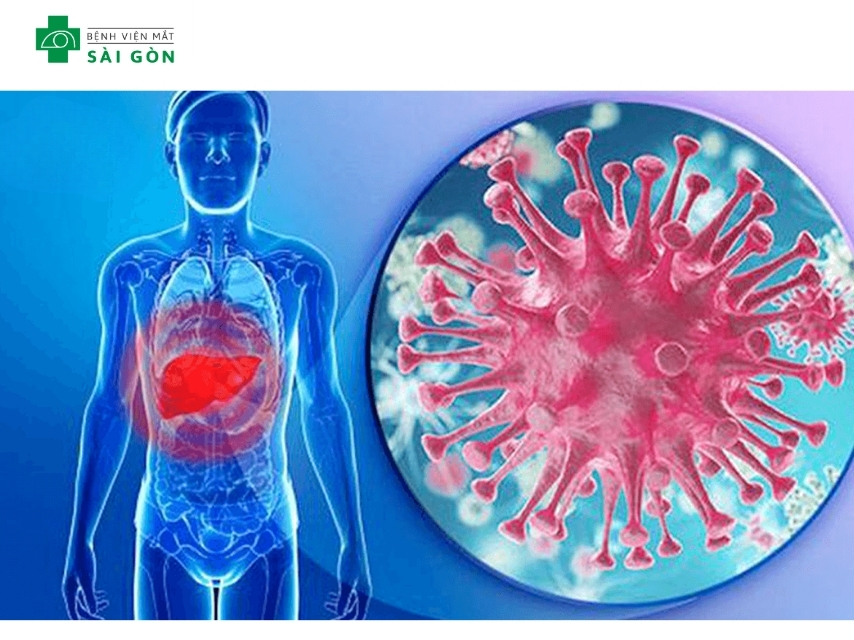 Mắt vàng là dấu hiệu bệnh lý về gan