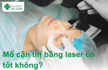 Mổ cận bằng laser là phương pháp an toàn an toàn
